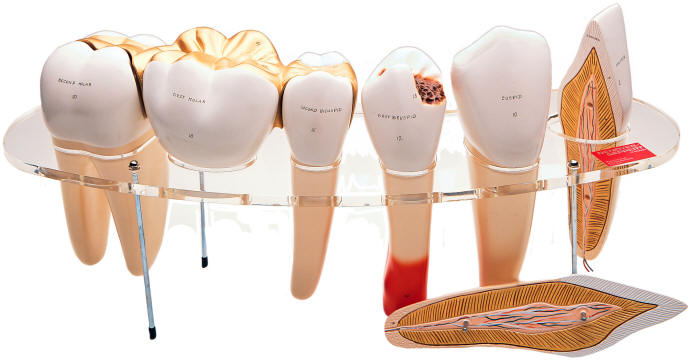 Human Tooth Models